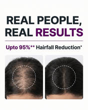 Load image into Gallery viewer, Hair Growth Serum - 30 ML
