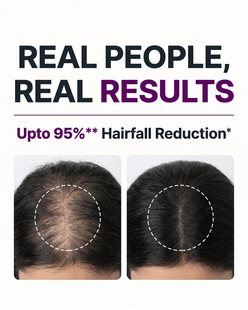 Anti-Hairfall Scalp Mask - 200ml