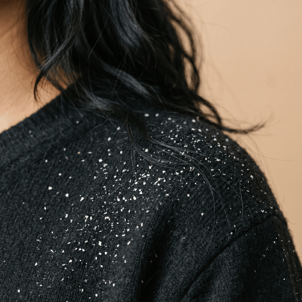 Dandruff