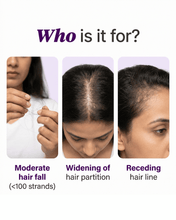 Load image into Gallery viewer, Hair Growth Serum - 30 ML