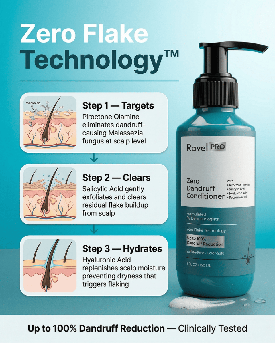 Anti-Dandruff Conditioner - 150 ML