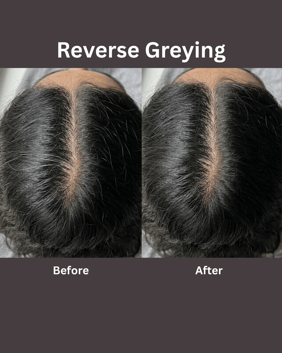Anti-Grey Hair Serum - 30ml
