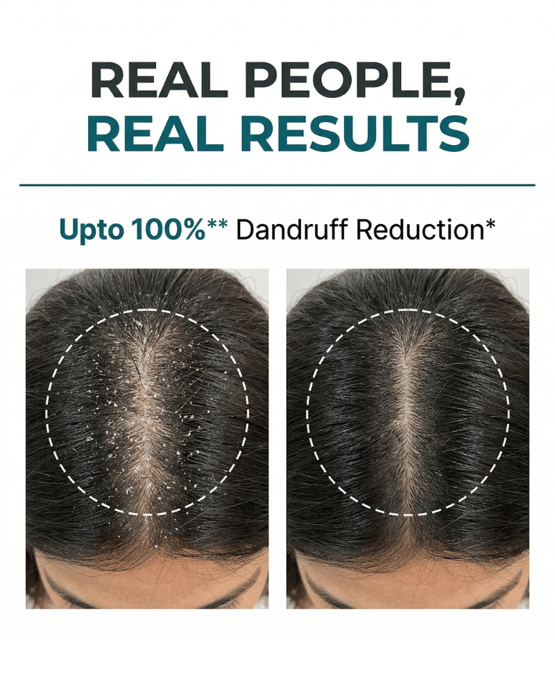 Anti-Dandruff Shampoo & Conditioner Set