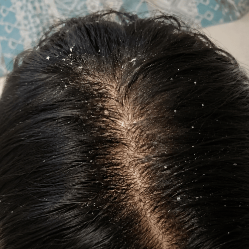 Aanya, 27 before