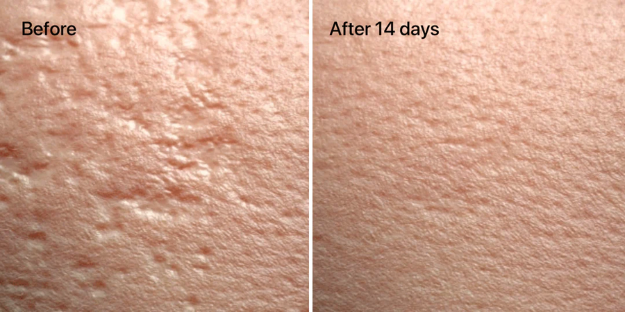 Unretouched skin results — image 1