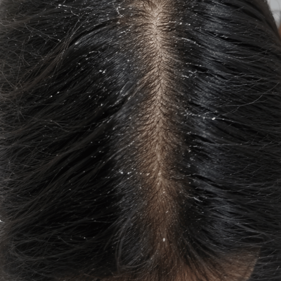 Person with healthy hair