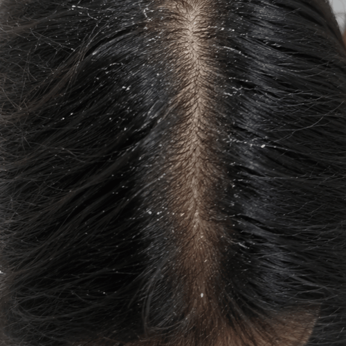 Aanya, 27 before