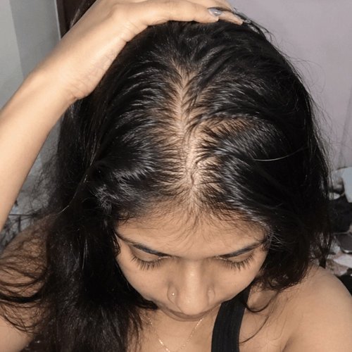 Aanya, 27 before