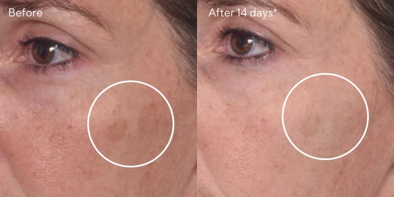 Unretouched skin results — image 2
